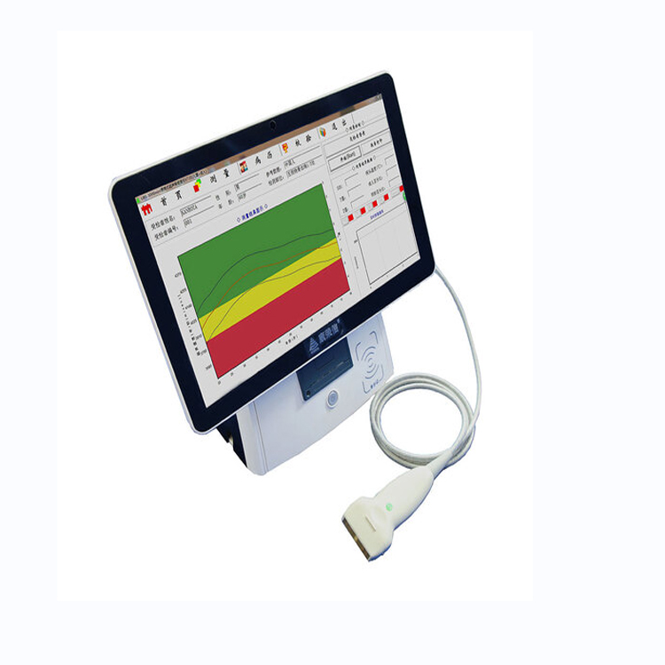 康荣信 便携式超声骨密度仪 UBS-3000mini 康荣信 便携式超声骨密度仪 UBS-3000mini
